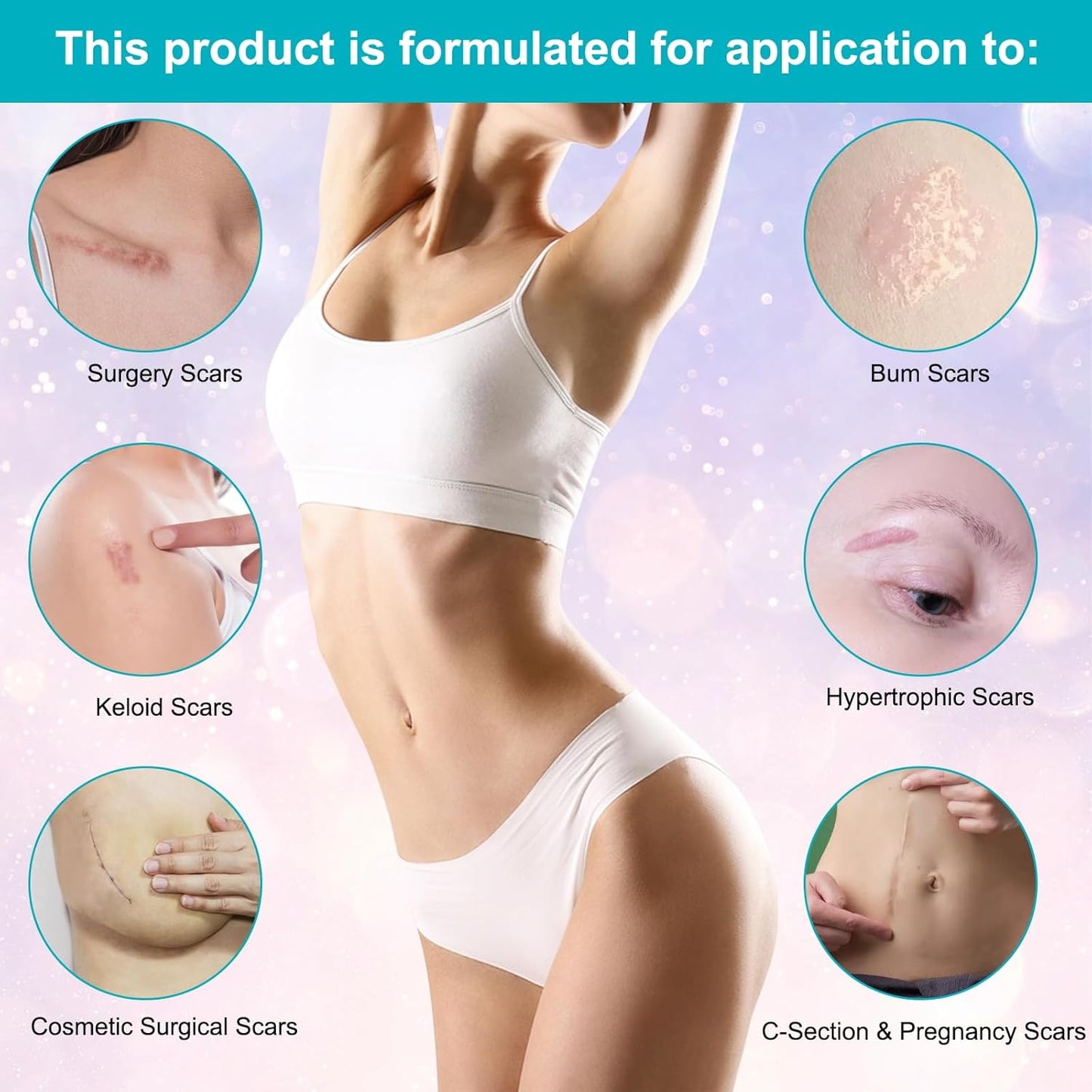 Scar Cream with Silicone Gel – Fades Old & New Scars from Surgery, C-Section, Burns, Acne, Piercing & Stretch Marks – Face & Body Use