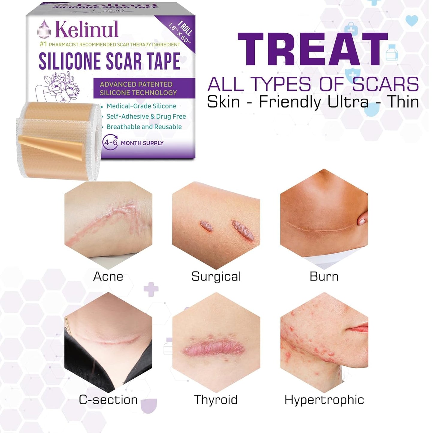 Silicone Scar Sheets – 1.6" x 60" Medical Grade Roll – Soft Gel Tape for C-Section & Surgery Scars – Reusable & Pain-Free Removal