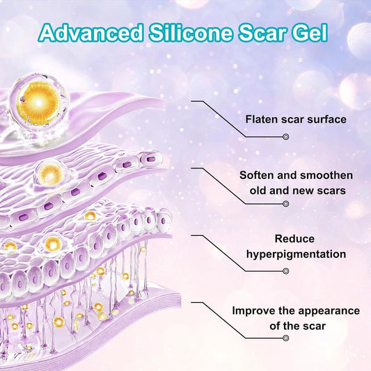 Scar Cream with Silicone Gel – Fades Old & New Scars from Surgery, C-Section, Burns, Acne, Piercing & Stretch Marks – Face & Body Use