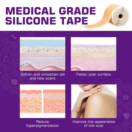 Silicone Scar Sheets – 1.6" x 60" Medical Grade Roll – Soft Gel Tape for C-Section & Surgery Scars – Reusable & Pain-Free Removal