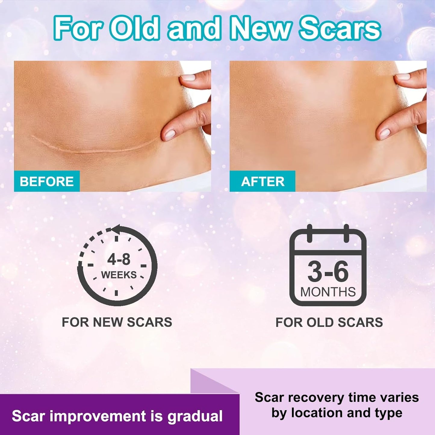 Scar Cream with Silicone Gel – Fades Old & New Scars from Surgery, C-Section, Burns, Acne, Piercing & Stretch Marks – Face & Body Use