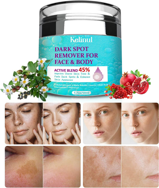 Dark Spot Remover for Face and Body – Fades Dark Spots, Acne Scars, Sun Damage & Uneven Tone – Fast Results with Advanced Ingredients (1.7 oz)