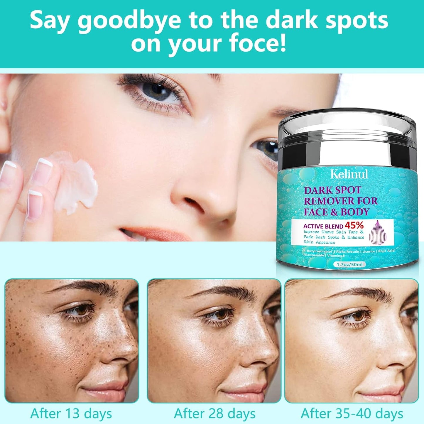 Dark Spot Remover for Face and Body – Fades Dark Spots, Acne Scars, Sun Damage & Uneven Tone – Fast Results with Advanced Ingredients (1.7 oz)