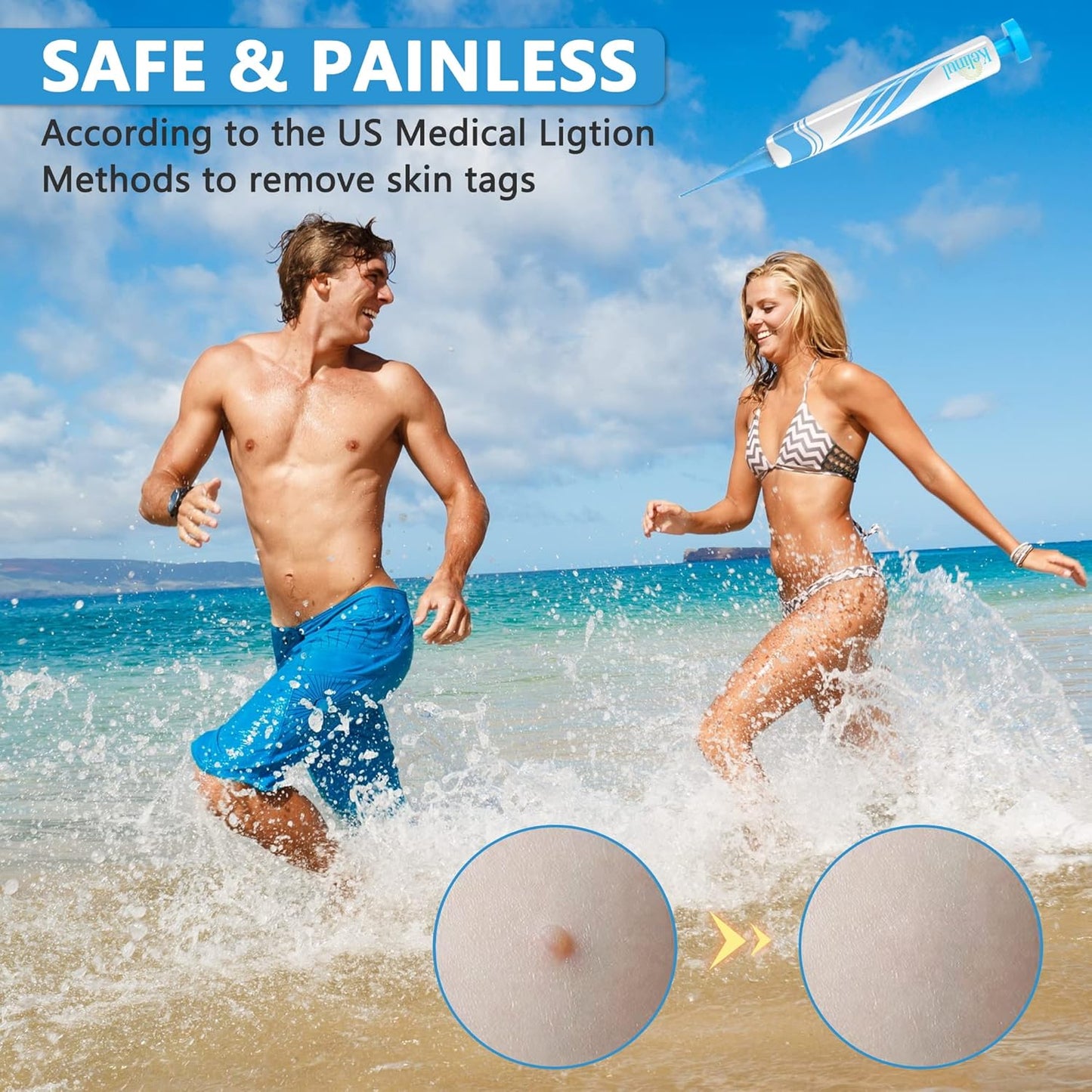 Kelinul Skin Tag Remover 2-in-1 Kit – Painless Removal for Small (2mm) to Large (8mm) Skin Tags – Includes 48 Bands & Precision Device – Safe for Most Skin Types